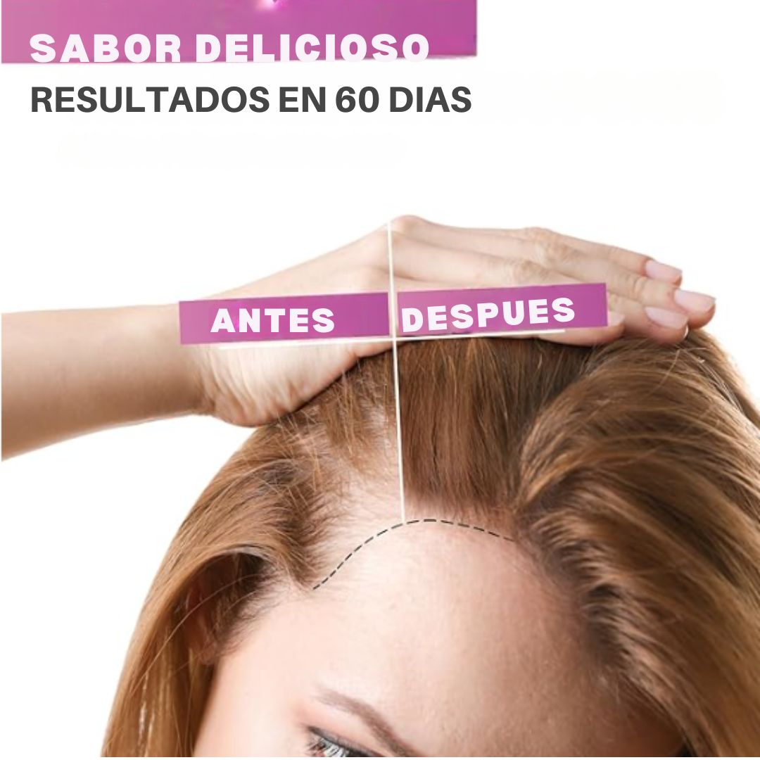 Gomitas Anti-Caída de Cabello QQZOFG® Con 60% Descuento🔥+ Multivitamínico Para crecimiento Gratis🎁