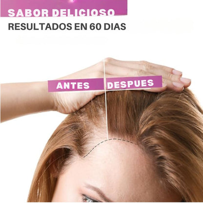 Gomitas Anti-Caída de Cabello QQZOFG® Con 60% Descuento🔥+ Multivitamínico Para crecimiento Gratis🎁