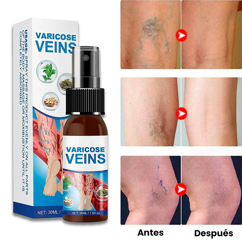 Timilk® VeinGuard Herbal Spray- ¡Contribuye a los sintómas fisicos y visuales de las varices!