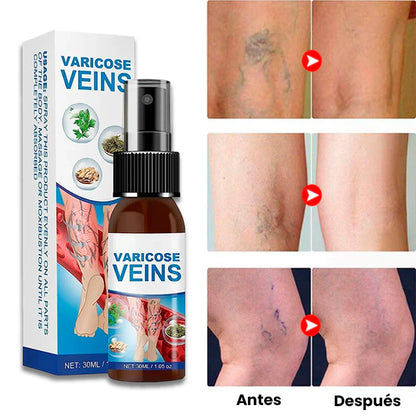 Timilk® VeinGuard Herbal Spray- ¡Contribuye a los sintómas fisicos y visuales de las varices!